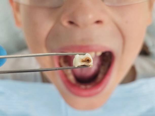 Best Emergency Treatment for Toothache in West Cape May, NJ